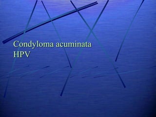 Condyloma acuminata
HPV
 