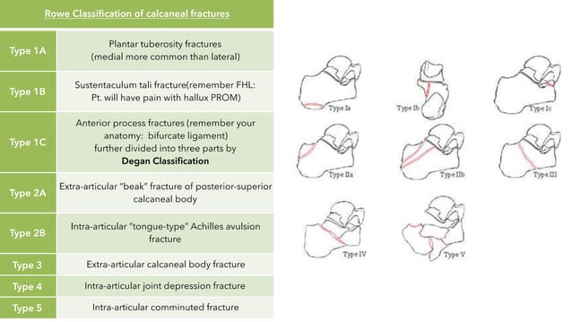 Rhowe Classification AJM Sheet: Calc Fracture | PPTX | Death, Injury, or Military Conflict ...
