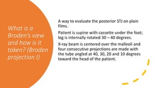 AJM Sheet: Calc Fracture | PPTX
