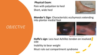 OBJECTIVE
Physical Exam:
Pain with palpation to heel
Short, wide heel
Mondor’s Sign: Characteristic ecchymosis extending
into plantar medial foot
Hoffa’s sign: Less taut Achilles tendon on involved
side
Inability to bear weight
Must rule out compartment syndrome
 