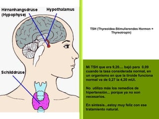 PPS: AZV2
Mi TSH que era 9,20.... bajó para 0,09
cuando la tasa considerada normal, en
un organismo en que la tiroide funciona
normal va de 0,27 la 4,20 mUi.
No utilizo más los remedios de
hipertensión... porque ya no son
necesarios.
En síntesis...estoy muy feliz con ese
tratamiento natural.
TSH (Thyreoidea-Stimulierendes Hormon =
Thyreotropin)
 