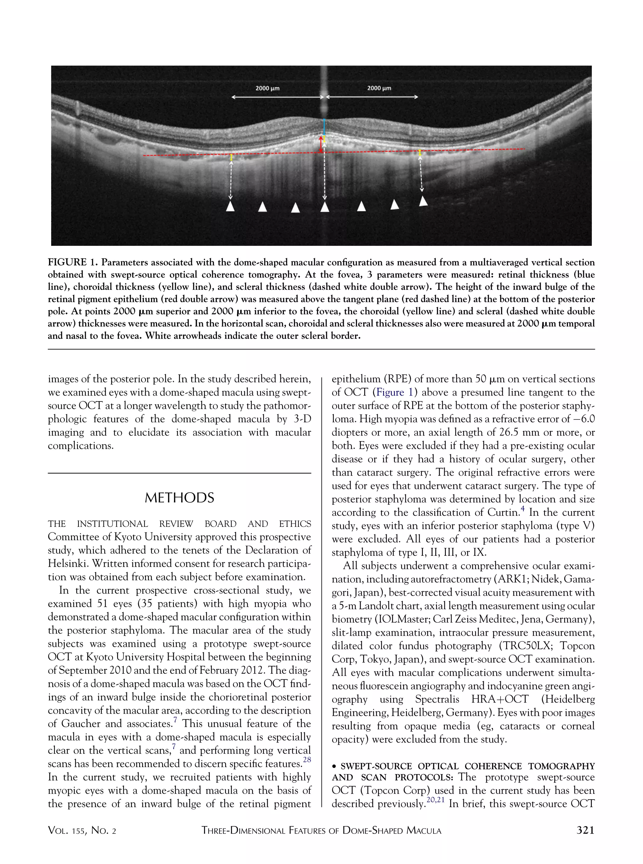 Dome Shaped Macula Pdf