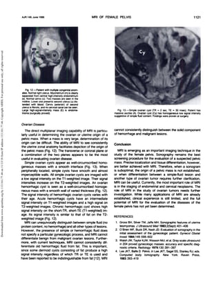 MRI of the Female Pelvis | PDF
