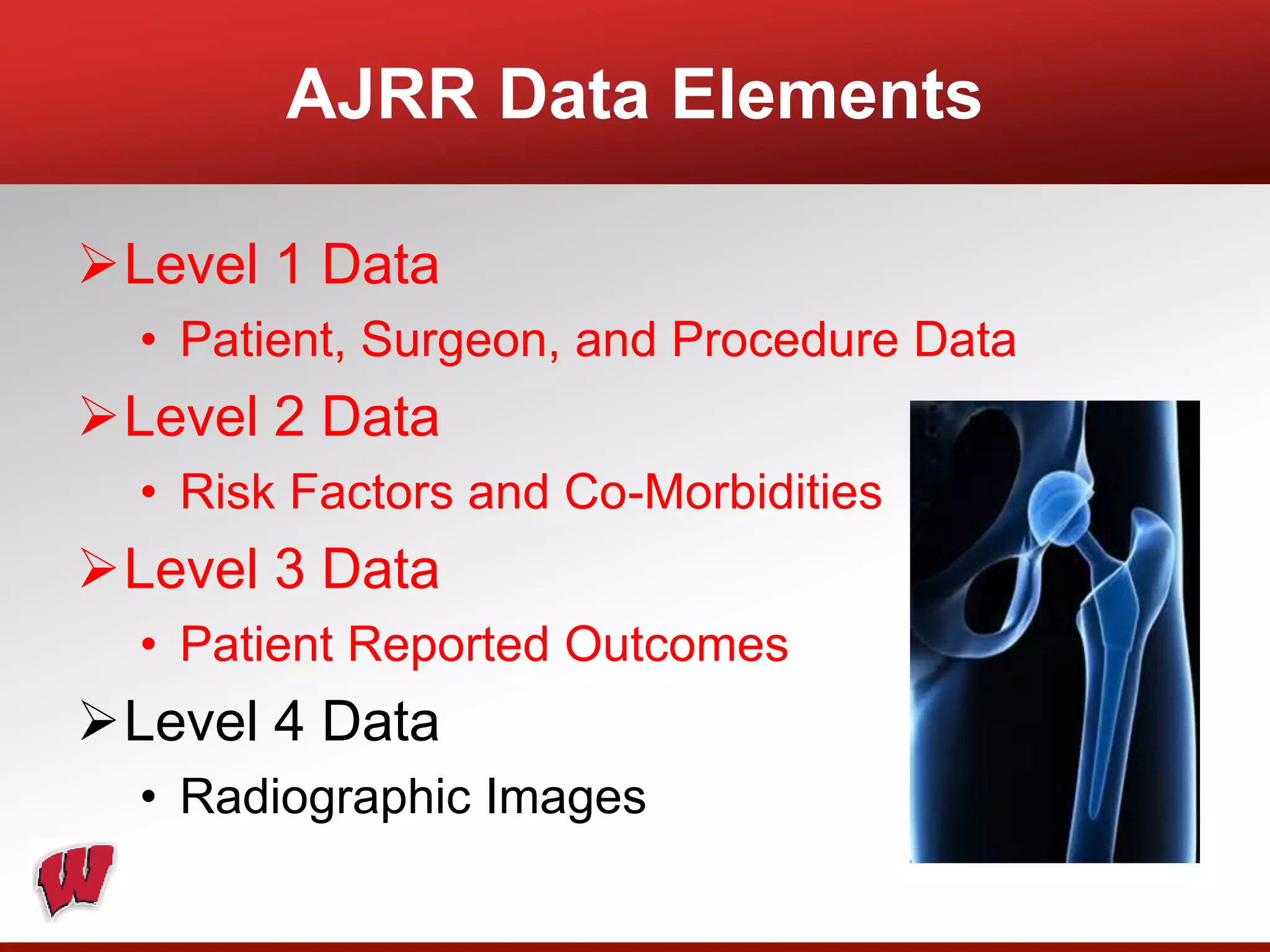 AJRR Data Elements
Level 1 Data
• Patient, Surgeon, and Procedure Data
Level 2 Data
• Risk Factors and Co-Morbidities
Level 3 Data
• Patient Reported Outcomes
Level 4 Data
• Radiographic Images
 
