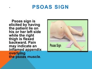Psoas Sign