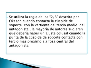    Se utiliza la regla de los “2/3” descrita por
    Okeson cuando contacta la cúspide de
    soporte con la vertiente del tercio medio del
    antagonista , la mayoría de autores sugieren
    que debería haber un ajuste oclusal cuando la
    punta de la cúspide de soporte contacta con
    tercio mas próximo ala fosa central del
    antagonista
 