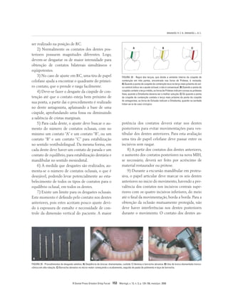 BRANDÃO, R. C. B.; BRANDÃO, L. B. C.
R Dental Press Ortodon Ortop Facial 153 Maringá, v. 13, n. 3, p. 124-156, maio/jun. 2008
FIGURA 29 - Procedimentos de desgaste seletivo. A) Seqüência de brocas: diamantadas, carbide 12 lâminas e borracha abrasiva. B) Uso de broca diamantada tronco-
cônica em alta rotação. C) Borracha abrasiva no micro-motor começando o acabamento, seguido de pasta de polimento e taça de borracha.
B C
A
FIGURA 28 - Regra dos terços, que divide a vertente interna da cúspide de
contenção em três partes, encontrada nos livros de Prótese, é revisada.
A) Quando a ponta da cúspide de contenção toca no terço mais próximo do sul-
co central indica-se o ajuste oclusal, e isto é consensual. B) Quando a ponta da
cúspide contata o terço médio, os livros de Prótese indicam coroas ou próteses
fixas, quando a Ortodontia deveria ser a melhor solução. C) Só quando a ponta
da cúspide de contenção contata o terço mais próximo da ponta da cúspide
do antagonista, os livros de Oclusão indicam a Ortodontia, quando na verdade
tratar-se-ia de caso cirúrgico.
A B C
ser realizado na posição de RC.
2) Normalmente os contatos dos dentes pos-
teriores possuem magnitudes diferentes. Logo,
devem-se desgastar os de maior intensidade para
obtenção de contatos bilaterais simultâneos e
eqüipotentes.
3) No caso de ajuste em RC, uma tira de papel
celofane ajuda a encontrar o quadrante do primei-
ro contato, que o prende e rasga facilmente.
4) Deve-se fazer o desgaste da cúspide de con-
tenção até que o contato esteja bem próximo de
sua ponta, a partir daí o procedimento é realizado
no dente antagonista, aplainando a base de uma
cúspide, aprofundando uma fossa ou diminuindo
a saliência de cristas marginais.
5) Para cada dente, o ajuste deve buscar o au-
mento do número de contatos oclusais, com no
mínimo um contato “A” e um contato “B”, ou um
contato “B” e um contato “C” para estabilização
no sentido vestibulolingual. Da mesma forma, em
cada dente deve haver um contato de parada e um
contato de equilíbrio, para estabilização dentária e
mandibular no sentido mesiodistal.
6) À medida que desgastes são realizados, au-
menta-se o número de contatos oclusais, o que é
desejável, podendo levar potencialmente ao esta-
belecimento de todos os tipos de contatos para o
equilíbrio oclusal, em todos os dentes.
7) Existe um limite para os desgastes oclusais.
Este momento é definido pelo contato nos dentes
anteriores, pois estes aceitam pouco ajuste devi-
do à espessura de esmalte e necessidade de con-
trole da dimensão vertical do paciente. A maior
potência dos contatos deverá estar nos dentes
posteriores para evitar movimentações para ves-
tibular dos dentes anteriores. Para esta avaliação
uma tira de papel celofane deve passar entre os
incisivos sem rasgar.
8) A partir dos contatos dos dentes anteriores,
o aumento dos contatos posteriores na nova MIH,
se necessário, deverá ser feito por acréscimo de
material restaurador ou prótese.
9) Durante a excursão mandibular em protru-
siva, o papel articular deve marcar os seis dentes
anteriores no início do movimento, havendo a pre-
valência dos contatos nos incisivos centrais supe-
riores com os quatro incisivos inferiores, do meio
até o final da movimentação, borda a borda. Para a
obtenção da oclusão mutuamente protegida, não
deve haver interferências nos dentes posteriores
durante o movimento. O contato dos dentes an-
 