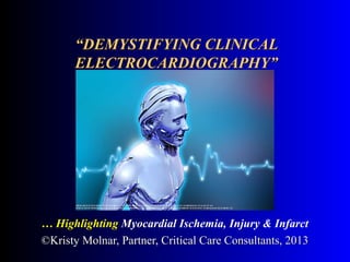 ““DEMYSTIFYING CLINICALDEMYSTIFYING CLINICAL
ELECTROCARDIOGRAPHY”ELECTROCARDIOGRAPHY”
…… HHighlightingighlighting Myocardial Ischemia, Injury & Infarct
©Kristy Molnar, Partner, Critical Care Consultants, 2013©Kristy Molnar, Partner, Critical Care Consultants, 2013
 