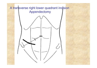 Clinical anatomy abdomin and details about this | PDF