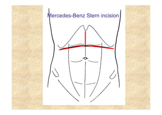 Clinical anatomy abdomin and details about this | PDF