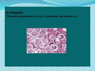 c
d.) Parasitic
*Parasitic pneumonia caused by protozoa, nematodes etc.
 