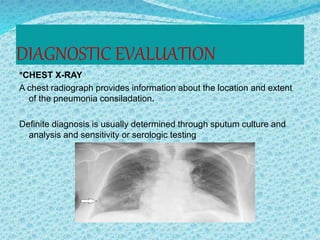 DIAGNOSTIC EVALUATION
*CHEST X-RAY
A chest radiograph provides information about the location and extent
of the pneumonia consiladation.
Definite diagnosis is usually determined through sputum culture and
analysis and sensitivity or serologic testing
 