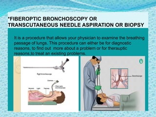 *FIBEROPTIC BRONCHOSCOPY OR
TRANSCUTANEOUS NEEDLE ASPIRATION OR BIOPSY
It is a procedure that allows your physician to examine the breathing
passage of lungs. This procedure can either be for diagnostic
reasons, to find out more about a problem or for therauptic
reasons,to treat an existing problems.
 