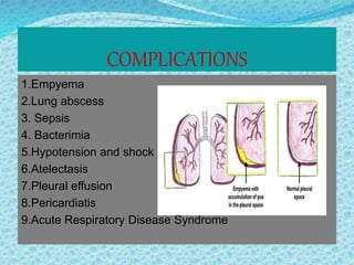 COMPLICATIONS
1.Empyema
2.Lung abscess
3. Sepsis
4. Bacterimia
5.Hypotension and shock
6.Atelectasis
7.Pleural effusion
8.Pericardiatis
9.Acute Respiratory Disease Syndrome
 