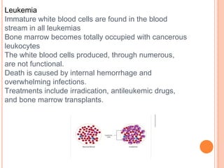Leukemia
Immature white blood cells are found in the blood
stream in all leukemias
Bone marrow becomes totally occupied with cancerous
leukocytes
The white blood cells produced, through numerous,
are not functional.
Death is caused by internal hemorrhage and
overwhelming infections.
Treatments include irradication, antileukemic drugs,
and bone marrow transplants.
 