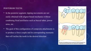 Teeth Incliners Comprehensive Biomechanics of Orthodontic Aligners and Attachments | PPTX