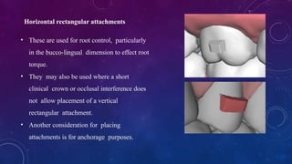 Rectangular Attachment Comprehensive Biomechanics of Orthodontic Aligners and Attachments | PPTX