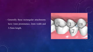 Rectangular Attachment Comprehensive Biomechanics of Orthodontic Aligners and Attachments | PPTX