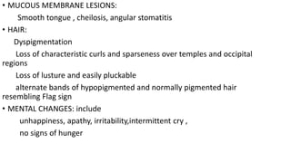 • MUCOUS MEMBRANE LESIONS:
Smooth tongue , cheilosis, angular stomatitis
• HAIR:
Dyspigmentation
Loss of characteristic curls and sparseness over temples and occipital
regions
Loss of lusture and easily pluckable
alternate bands of hypopigmented and normally pigmented hair
resembling Flag sign
• MENTAL CHANGES: include
unhappiness, apathy, irritability,intermittent cry ,
no signs of hunger
 