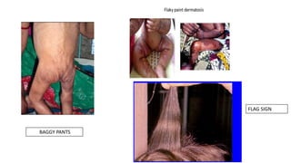 FLAG SIGN
BAGGY PANTS
 