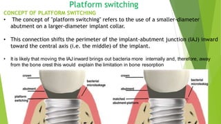 Recent Advances in Implanty Dentistry | PPTX
