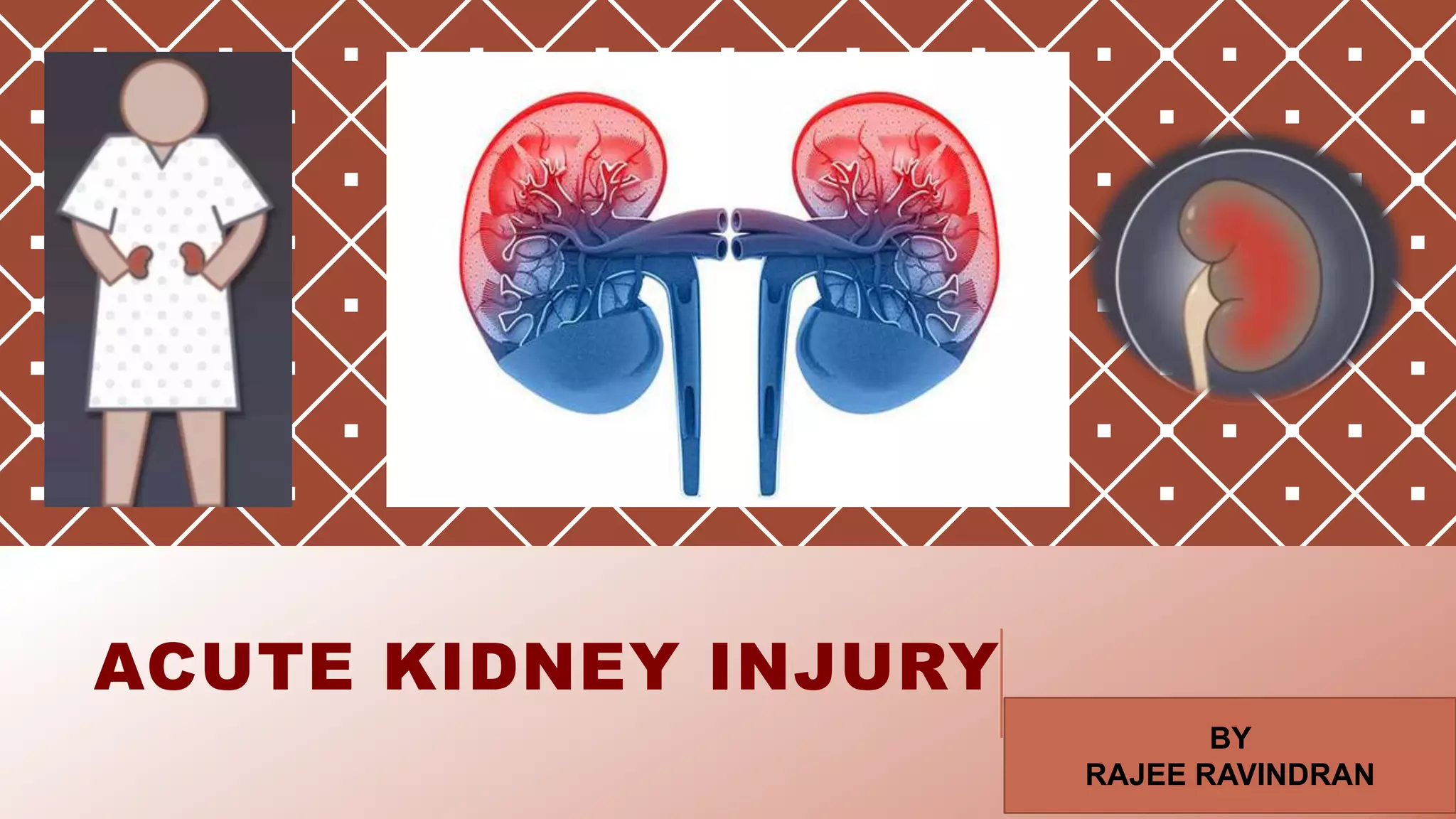 ACUTE KIDNEY INJURY AND MANAGEMENT | PPTX