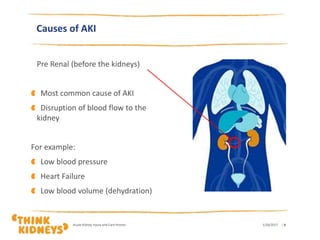 Causes of AKI
Pre Renal (before the kidneys)
Most common cause of AKI
Disruption of blood flow to the
kidney
For example:
Low blood pressure
Heart Failure
Low blood volume (dehydration)
1/26/2017Acute Kidney Injury and Care Homes | 9
 