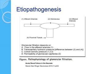 Etiopathogenesis
Acute Renal Failure in the Neonate
Steven Alan Ringer Neoreviews 2010;11;e243
 