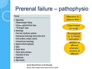 Prerenal failure – pathophysio
Alteration in
plasma flow
Catecholami
ne surge
Prostagland
in & RAAS
activation
Dilation of
afferent
arteriole /
constric of
efferent
Acute Renal Failure in the Neonate
Steven Alan Ringer Neoreviews 2010;11;e243
 