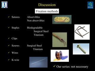 Sutures  Absorvibles Non absorvibles Staples Biodegradable   Surgical Steel   Titanium Clips Screws Surgical Steel   Titanium Wires K-wire Fixation methods Discussion Our series: not necessary 