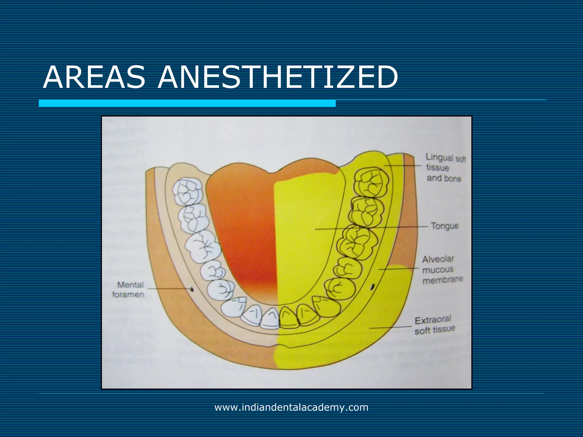 Akinosi & gow gates nerve blocks / prosthodontic courses | PPT | Ear ...