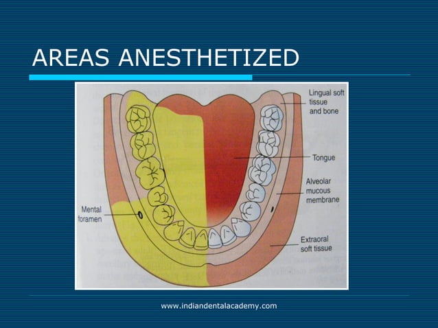 Akinosi & gow gates nerve blocks / prosthodontic courses | PPT | Ear ...