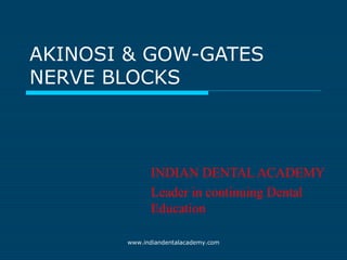 AKINOSI & GOW-GATES
NERVE BLOCKS
INDIAN DENTAL ACADEMY
Leader in continuing Dental
Education
www.indiandentalacademy.com
 