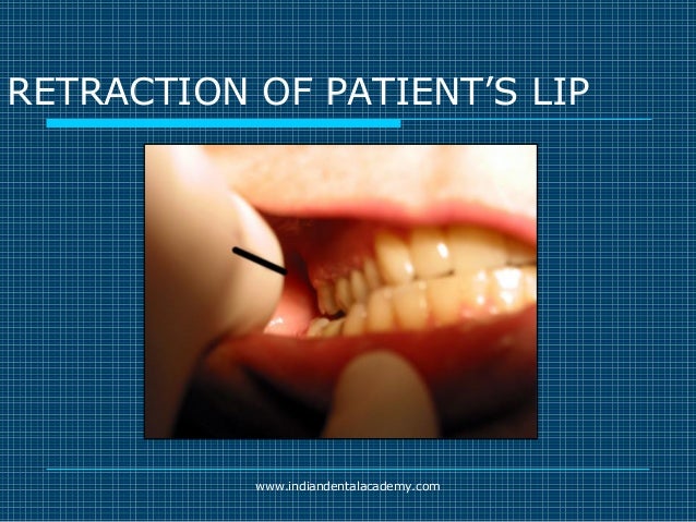 Akinosi & gow gates nerve blocks / prosthodontic courses