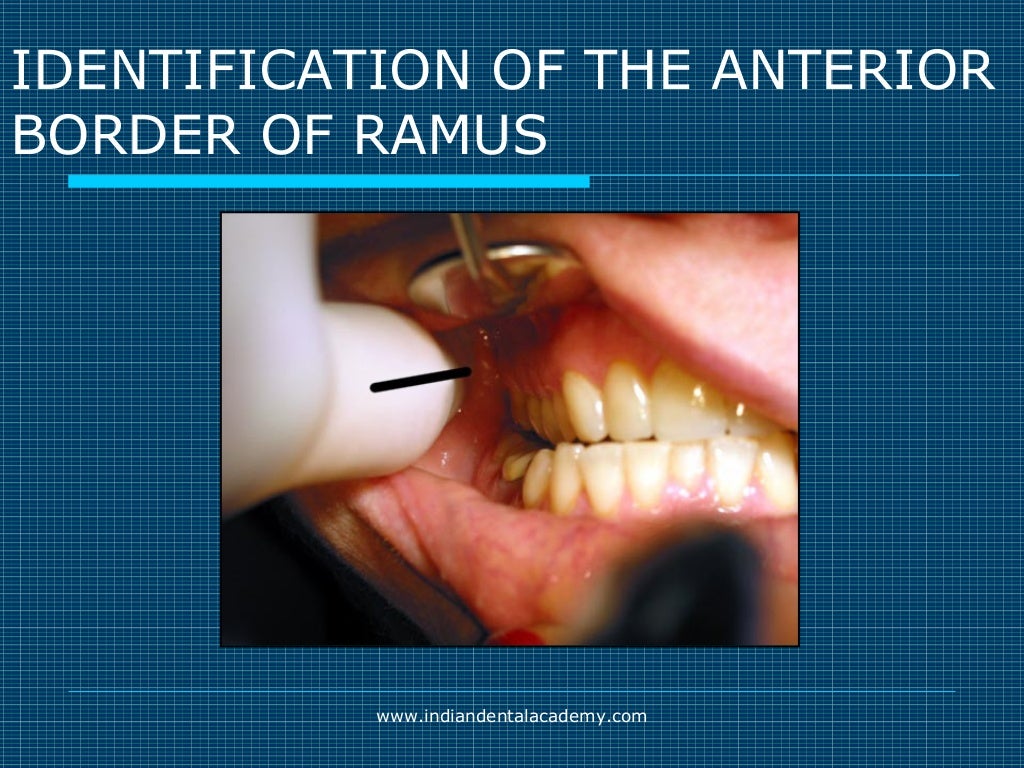Akinosi & gow gates nerve blocks / prosthodontic courses