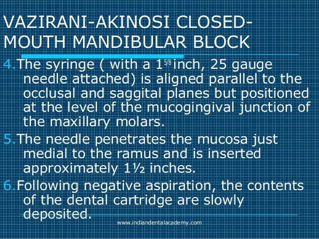 Akinosi & gow gates nerve blocks / prosthodontic courses