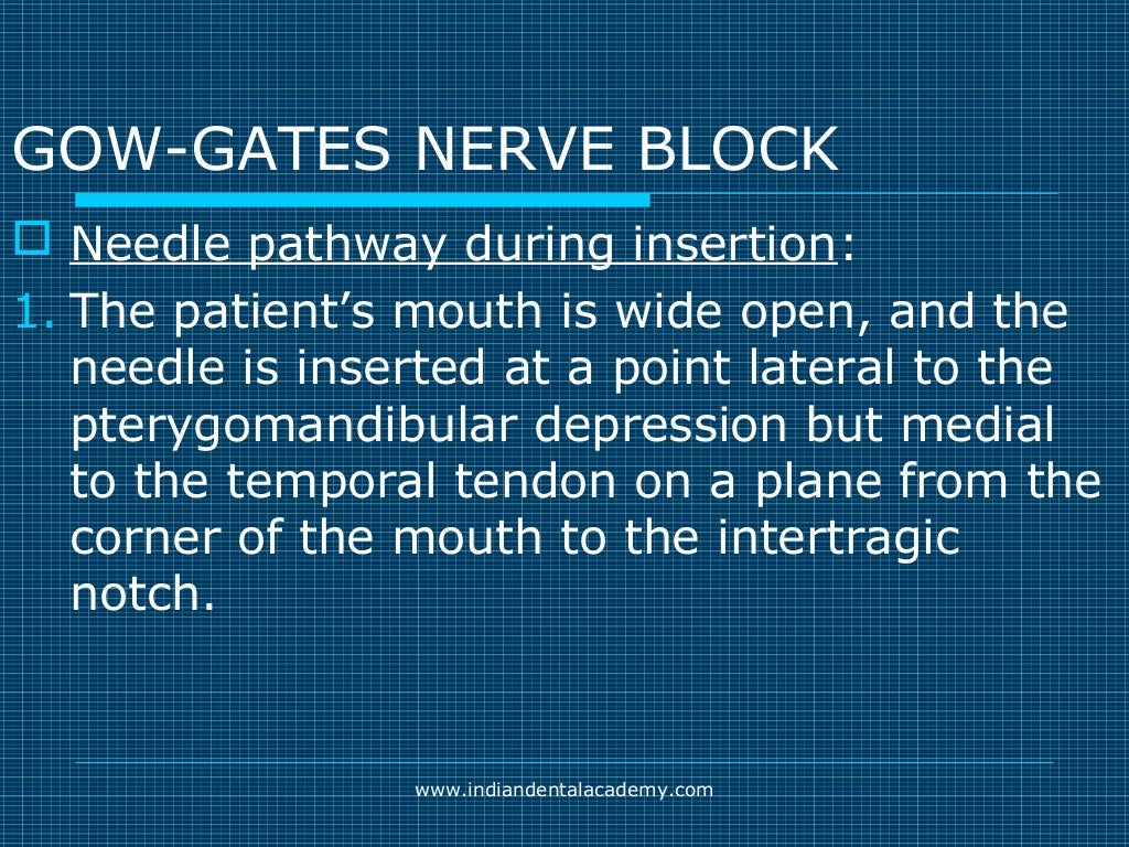 Akinosi & gow gates nerve blocks / prosthodontic courses