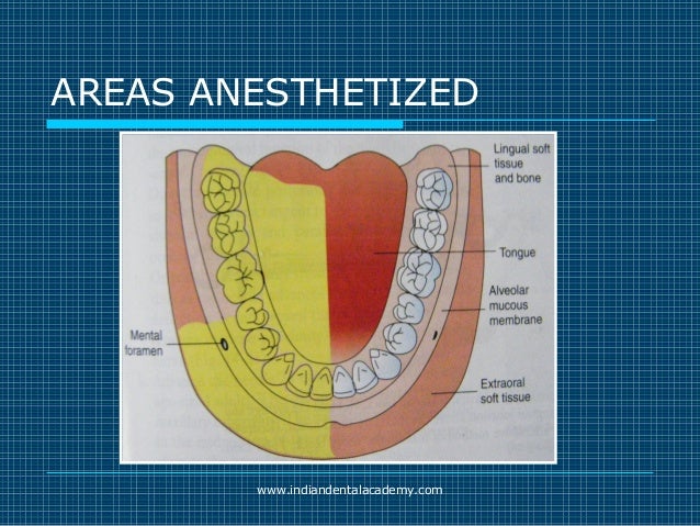 Akinosi & gow gates nerve blocks / prosthodontic courses