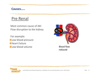 Causes…..
Pre Renal
Most common cause of AKI
Flow disruption to the kidney
For example:
Low blood pressure
Heart Failure
Low blood volume Blood flow
reduced
DateAcute Kidney Injury National Programme | Implications for community & practice nurses | Claire Stocks | 7
 