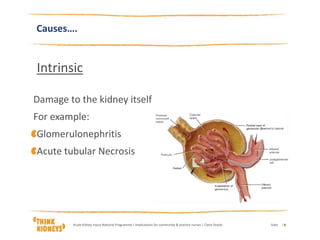 Causes….
Intrinsic
Damage to the kidney itself
For example:
Glomerulonephritis
Acute tubular Necrosis
DateAcute Kidney Injury National Programme | Implications for community & practice nurses | Claire Stocks | 8
 