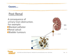 Causes….
Post Renal
A consequence of
urinary tract obstruction.
For example:
Blocked catheter
Renal calculi
Bladder tumours
DateAcute Kidney Injury National Programme | Implications for community & practice nurses | Claire Stocks | 9
 