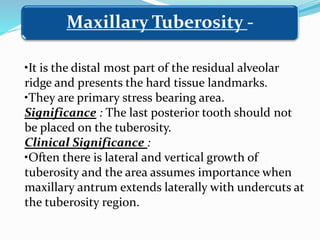 •It is the distal most part of the residual alveolar
ridge and presents the hard tissue landmarks.
•They are primary stress bearing area.
Significance : The last posterior tooth should not
be placed on the tuberosity.
Clinical Significance :
•Often there is lateral and vertical growth of
tuberosity and the area assumes importance when
maxillary antrum extends laterally with undercuts at
the tuberosity region.
Maxillary Tuberosity -
 