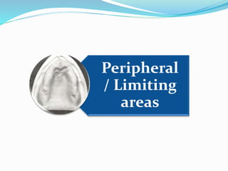 Peripheral
/ Limiting
areas
 