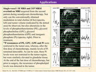 40
Applications
Single-voxel 1 H MRS and 31P MRSI
overlaid on MRI acquired from the second
patient during neoadjuvant chemotherapy. Not
only can the conventionally obtained
modulation in total choline (tCho) (spectra,
left) and tumor volume (indicated by the dotted
area) be observed, but also alterations in the
levels of phosphoethanolamine (PE), glycerol
phosphocholine (GPC), glycerol
phosphoethanolamine (GPE) and inorganic
phosphate (Pi) (spectra, right). Prior to
treatment,
31P resonances of PE, GPC, GPE and Pi were
restricted to the tumor area, whereas, after the
first dose of chemotherapy, mainly levels of Pi
remained detectable. As can be seen, these Pi
levels were not restricted to the tumor region,
but were similarly elevated in glandular tissue.
At the end of the last dose of chemotherapy, but
prior to surgery, the recurrence of phospholipid
levels was detected in the tumor.
Dennis W. J. K.; Bart B.D. 31P MRSI and 1 H MRS at 7 T: initial results in human breast cancer. NMR Biomed. 2011; 24: 1337–1342.
 