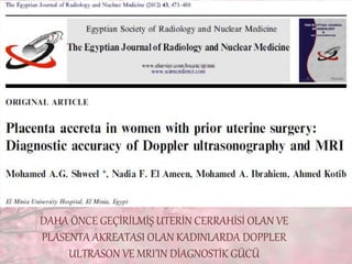 DAHA ÖNCE GEÇİRİLMİŞ UTERİN CERRAHİSİ OLAN VE
PLASENTA AKREATASI OLAN KADINLARDA DOPPLER
ULTRASON VE MRI’IN DİAGNOSTİK GÜCÜ
 