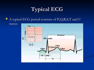 ECG Filtering Techniques And Methodologies | PPT