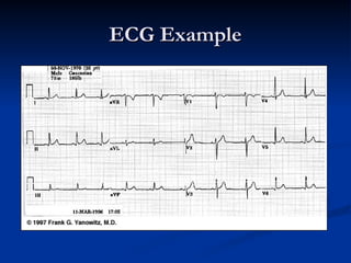 ECG Filtering Techniques And Methodologies | PPT