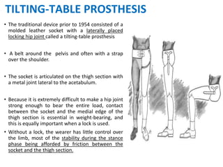 TILTING-TABLE PROSTHESIS
• The traditional device prior to 1954 consisted of a
molded leather socket with a laterally placed
locking hip joint called a tilting-table prosthesis
• A belt around the pelvis and often with a strap
over the shoulder.
• The socket is articulated on the thigh section with
a metal joint lateral to the acetabulum.
• Because it is extremely difficult to make a hip joint
strong enough to bear the entire load, contact
between the socket and the medial edge of the
thigh section is essential in weight-bearing, and
this is equally important when a lock is used.
• Without a lock, the wearer has little control over
the limb, most of the stability during the stance
phase being afforded by friction between the
socket and the thigh section.
 