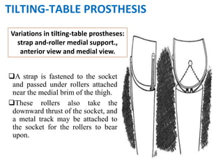 A strap is fastened to the socket
and passed under rollers attached
near the medial brim of the thigh.
These rollers also take the
downward thrust of the socket, and
a metal track may be attached to
the socket for the rollers to bear
upon.
Variations in tilting-table prostheses:
strap and-roller medial support.,
anterior view and medial view.
TILTING-TABLE PROSTHESIS
 