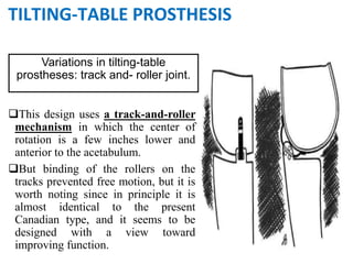 This design uses a track-and-roller
mechanism in which the center of
rotation is a few inches lower and
anterior to the acetabulum.
But binding of the rollers on the
tracks prevented free motion, but it is
worth noting since in principle it is
almost identical to the present
Canadian type, and it seems to be
designed with a view toward
improving function.
Variations in tilting-table
prostheses: track and- roller joint.
TILTING-TABLE PROSTHESIS
 